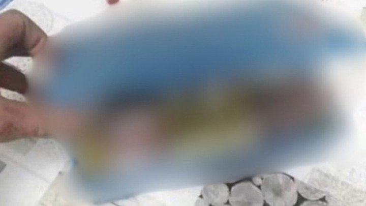 Foto: Što majstor drži u kutiji prve pomoći?